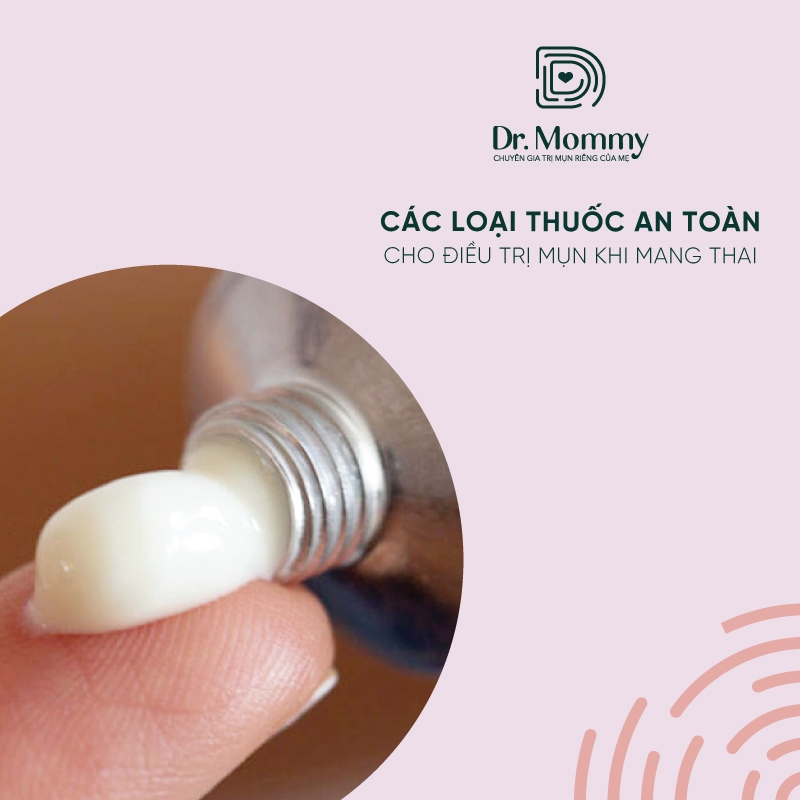 Thuốc Trị Mụn An Toàn Khi Mang Thai