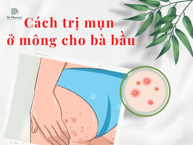 3. Cách trị mụn mông bằng nguyên liệu tự nhiên