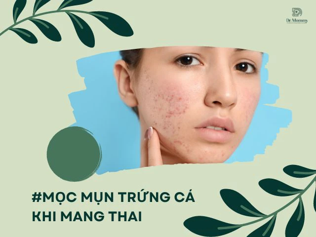 1. Nguyên nhân gây mụn trứng cá khi mang thai